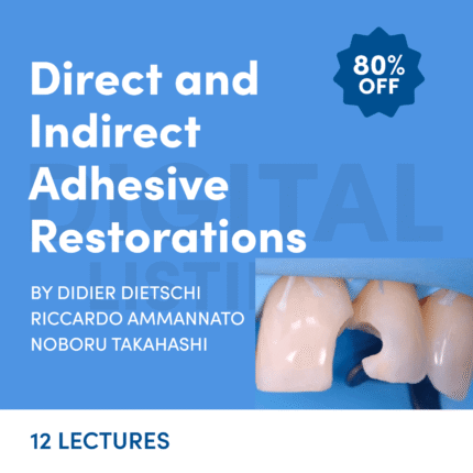 Direct and Indirect Adhesive Restorations