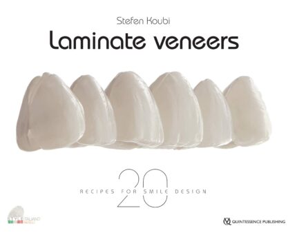 Laminate Veneers 20 Recipes for Smile Design 1st Edition