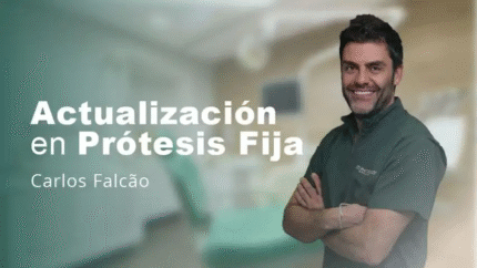 Actualizacion en Protesis Fija