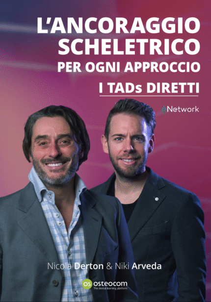 Sistemi di Ancaggio Scheletrico: I TADs Diretti per Ogni Caso Clinico