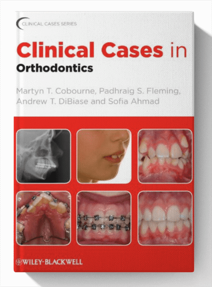 Clinical Cases in Orthodontics 1st Edition