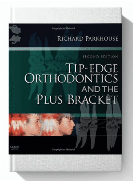 Tip Edge Orthodontics and the Plus Bracket 2nd Edition