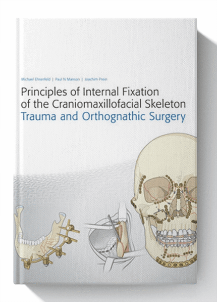 Principles of Internal Fixation of the Craniomaxillofacial Skeleton: Trauma and Orthognathic Surgery 1st Edition