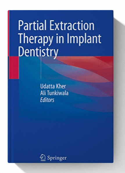 Partial Extraction Therapy in Implant Dentistry 1st ed